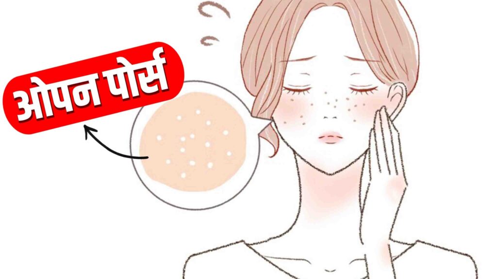 ओपन पोर्स को कैसे ठीक करे