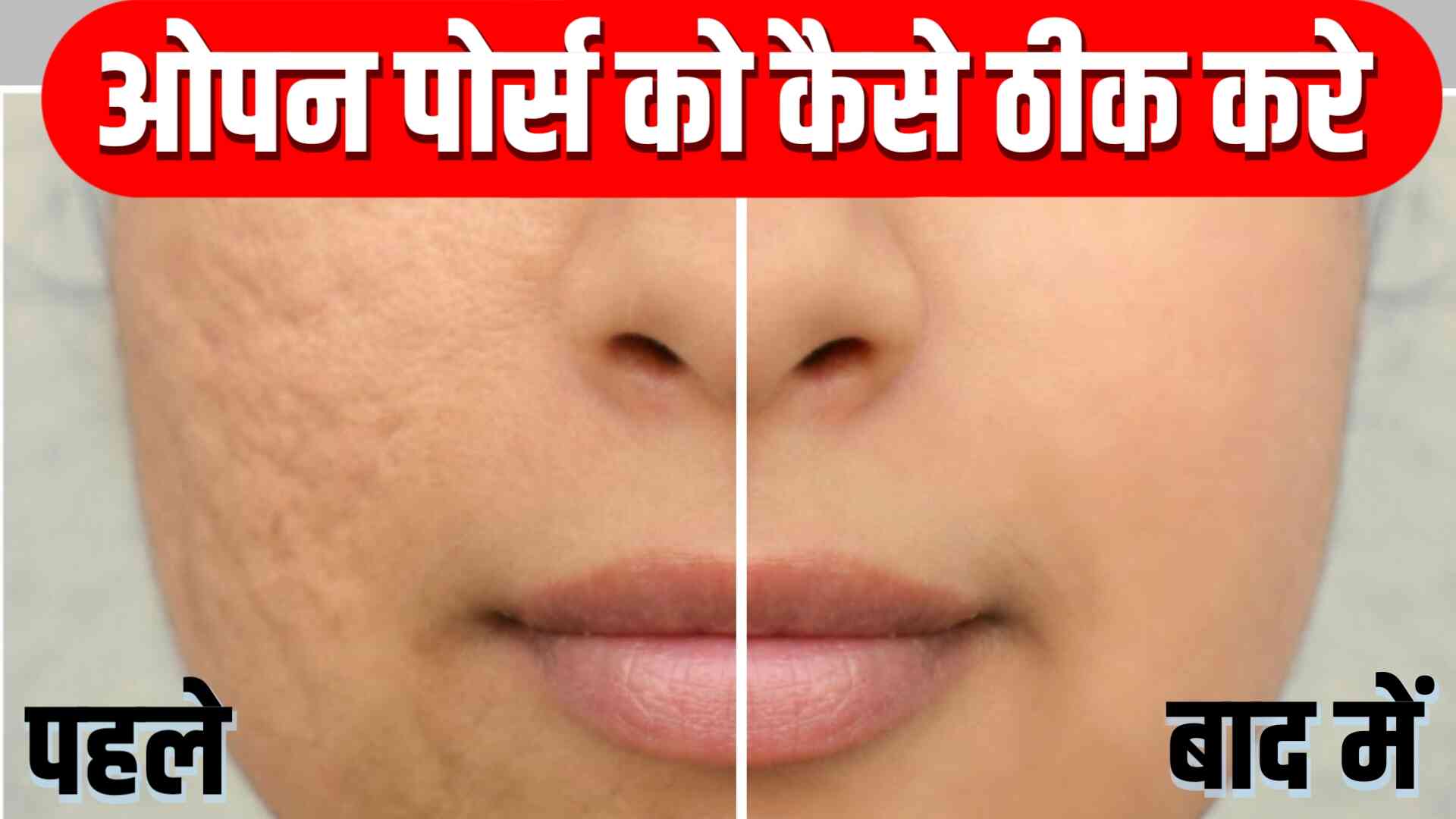 ओपन पोर्स को कैसे ठीक करे