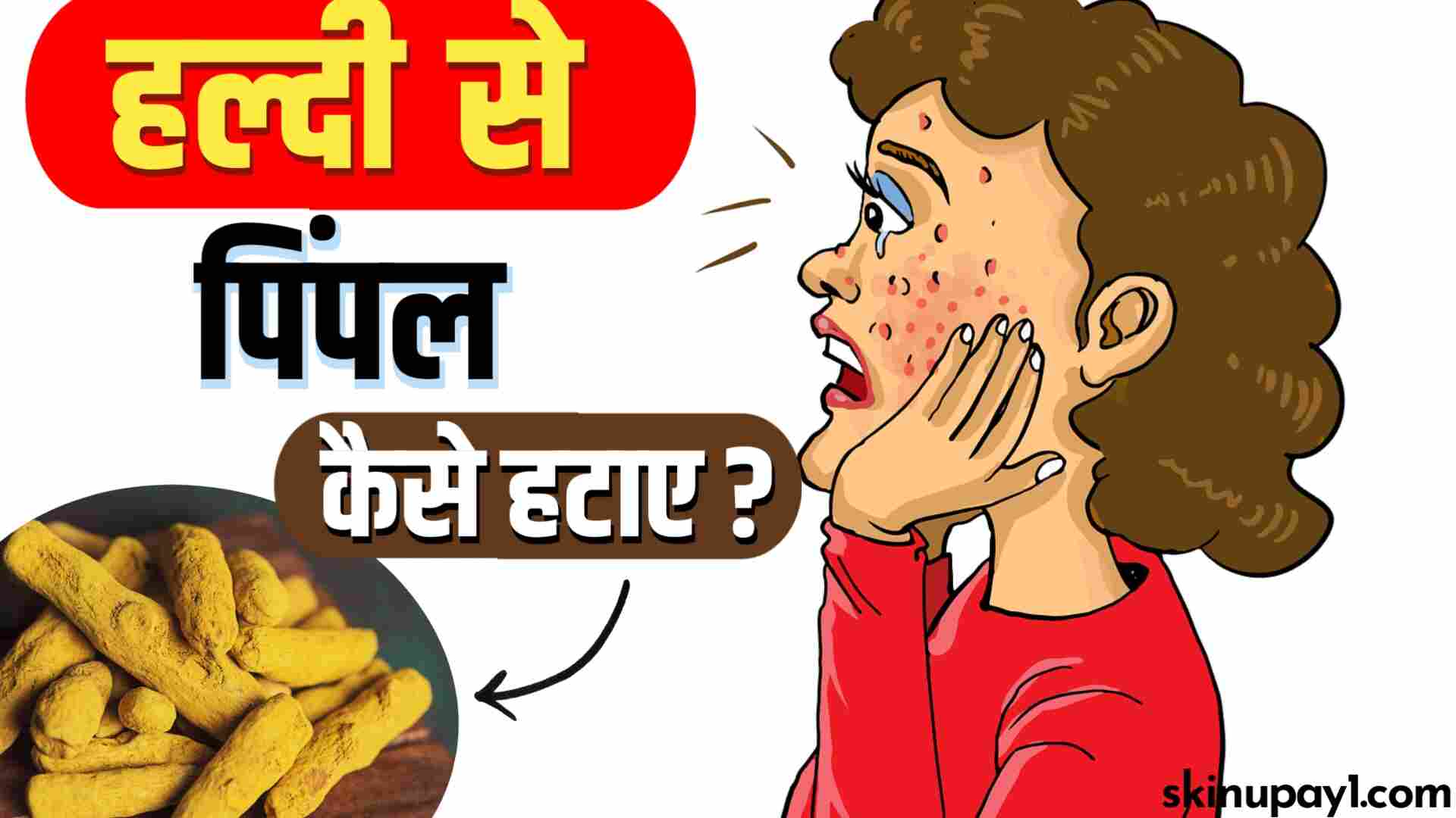 हल्दी से पिम्पल कैसे हटाए