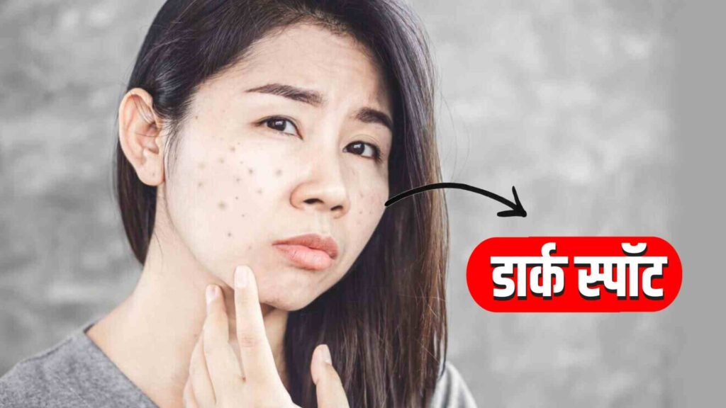 डार्क स्पॉट कैसे हटाए