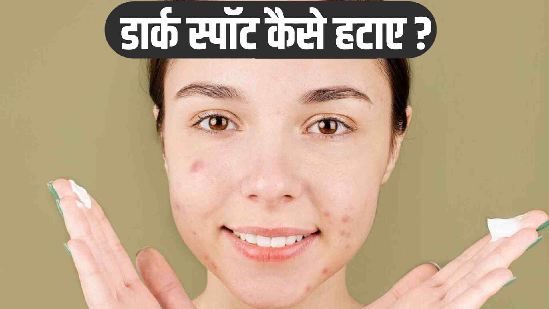 डार्क स्पॉट कैसे हटाए